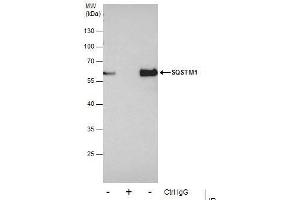 Image no. 7 for anti-Sequestosome 1 (SQSTM1) (Internal Region) antibody (ABIN2854836)