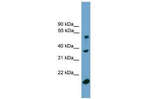 Image no. 1 for anti-Transducin (Beta)-Like 1, Y-Linked (TBL1Y) (Middle Region) antibody (ABIN928560)