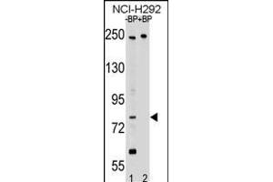 Western blot analysis of PL2 Antibody (N-term) Pab 17460a pre-incubated without(lane 1) and with(lane 2) blocking peptide in NCI- cell line lysate.