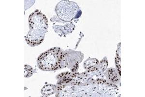 SNM1 antibody