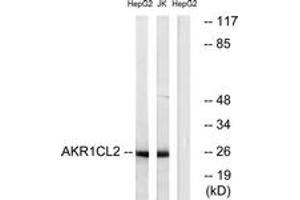Image no. 1 for anti-Aldo-Keto Reductase Family 1, Member E2 (AKR1E2) (AA 141-190) antibody (ABIN1534619)