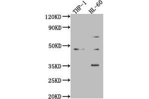 Western Blot Positive WB detected in: Mouse heart tissue, Mouse spleen tissue, Mouse lung tissue All lanes: ZKSCAN3 antibody at 4 μg/mL Secondary Goat polyclonal to rabbit IgG at 1/50000 dilution predicted band size: 61, 44 kDa observed band size: 61, 44 kDa