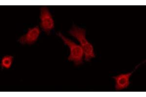 Image no. 1 for anti-Prostaglandin Reductase 1 (PTGR1) (Internal Region) antibody (ABIN6257814)