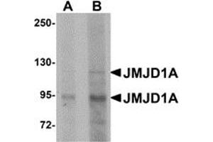 Image no. 1 for anti-Lysine (K)-Specific Demethylase 3A (KDM3A) (N-Term) antibody (ABIN1031423)