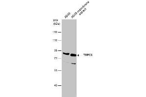 Image no. 2 for anti-Transient Receptor Potential Cation Channel, Subfamily C, Member 6 (TRPC6) (C-Term) antibody (ABIN2855924)
