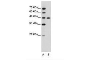 Image no. 2 for anti-HSPB (Heat Shock 27kDa) Associated Protein 1 (HSPBAP1) (AA 412-461) antibody (ABIN6736308)