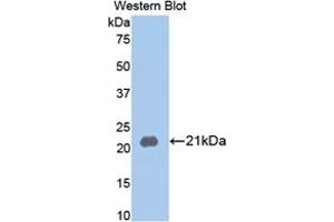 Image no. 3 for Matrix Metallopeptidase 13 (Collagenase 3) (MMP13) ELISA Kit (ABIN6720554)