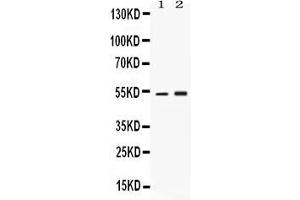 Image no. 1 for anti-serpin Peptidase Inhibitor, Clade A (Alpha-1 Antiproteinase, Antitrypsin), Member 1 (SERPINA1) (AA 25-204) antibody (ABIN4886719)