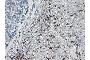 Image no. 5 for anti-Coagulation Factor XIII, A1 Polypeptide (F13A1) antibody (ABIN1498146)
