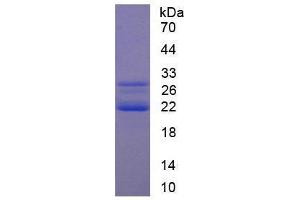 Image no. 1 for Cold Inducible RNA Binding Protein (CIRBP) (AA 1-172) (Active) protein (His tag) (ABIN6239789)
