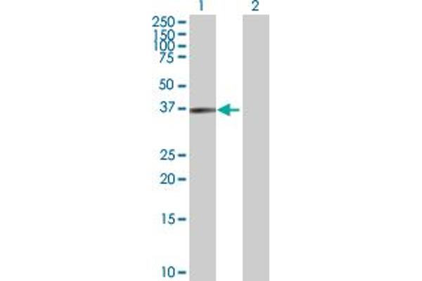 anti-Ubiquitin Specific Peptidase 46 (USP46) (AA 1-366) antibody