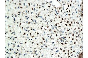 Formalin-fixed and paraffin embedded rat ovary tissue labeled with Anti-ER beta Polyclonal Antibody, Unconjugated (ABIN725210), followed by conjugation to the secondary antibody and DAB staining