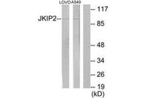 Image no. 1 for anti-Janus Kinase and Microtubule Interacting Protein 2 (JAKMIP2) (AA 761-810) antibody (ABIN1534062)