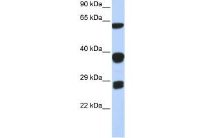Image no. 1 for anti-Small Nuclear Ribonucleoprotein Polypeptides B and B1 (SNRPB) (Middle Region) antibody (ABIN2778832)