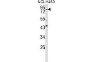 Image no. 3 for anti-Spastic Paraplegia 20 (Troyer Syndrome) (SPG20) (AA 24-54), (N-Term) antibody (ABIN954908)