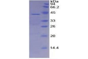 Image no. 5 for alpha-2-HS-Glycoprotein (AHSG) ELISA Kit (ABIN6730899)