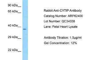 Image no. 1 for anti-Cytohesin 1 Interacting Protein (CYTIP) (N-Term) antibody (ABIN2789130)