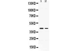 Image no. 2 for anti-Abhydrolase Domain Containing 5 (ABHD5) (AA 169-349) antibody (ABIN4886411)