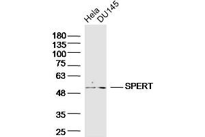 SPERT Antikörper  (AA 1-100)