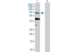 Image no. 1 for anti-Kelch-Like 7 (KLHL7) (AA 1-586) antibody (ABIN527828)