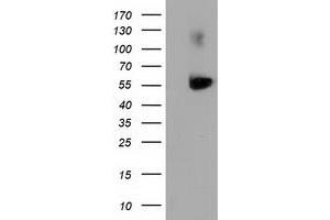 Image no. 1 for anti-Sequestosome 1 (SQSTM1) antibody (ABIN1499989)