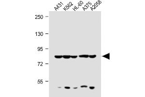 Image no. 5 for anti-ATP-Binding Cassette, Sub-Family B (MDR/TAP), Member 5 (ABCB5) (AA 1-30), (N-Term) antibody (ABIN390068)