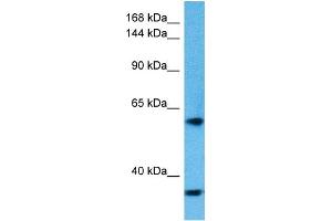 Image no. 1 for anti-Kinase D-Interacting Substrate, 220kDa (KIDINS220) (Middle Region) antibody (ABIN5516661)