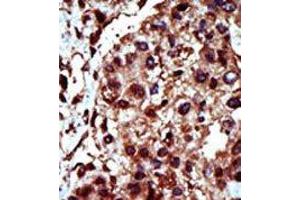 Image no. 1 for anti-Diacylglycerol Kinase, iota (DGKI) (C-Term) antibody (ABIN360602)