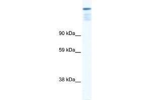Image no. 1 for anti-Zinc Finger Protein 106 Homolog (ZFP106) (N-Term) antibody (ABIN927435)