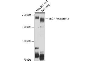 VEGFR2/CD309 抗体  (AA 20-200)