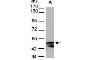 Image no. 1 for anti-Keratin 14 (KRT14) (Center) antibody (ABIN2855778)