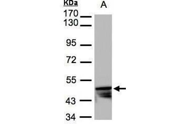 anti-Keratin 14 (KRT14) (Center) antibody