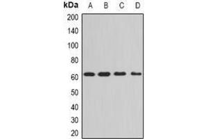 Image no. 1 for anti-Protein Phosphatase 3, Catalytic Subunit, alpha Isoform (PPP3CA) (full length) antibody (ABIN6005974)