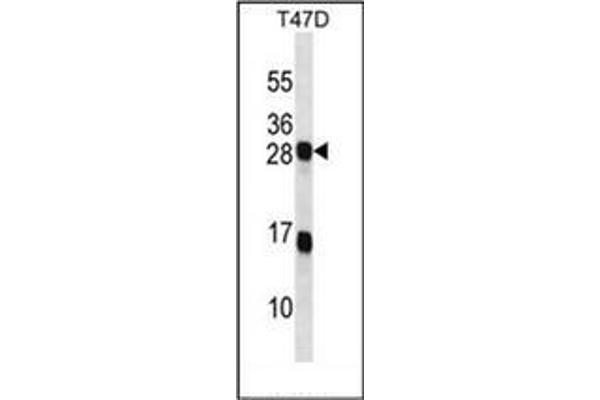 KDELR2 Antikörper  (C-Term)
