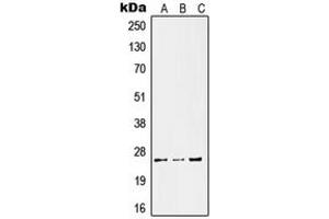 Image no. 1 for anti-Kallikrein 11 (KLK11) (Center) antibody (ABIN2706431)