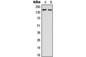 Image no. 1 for anti-Glutamate Receptor, Ionotropic, N-Methyl D-Aspartate 2D (GRIN2D) (Center) antibody (ABIN2972795)