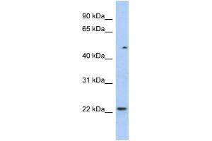 Image no. 1 for anti-Transcription Elongation Factor A (SII)-Like 3 (TCEAL3) (N-Term) antibody (ABIN2784303)