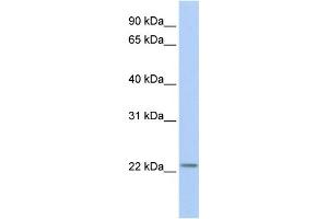 anti-Histone Cluster 1, H1t (HIST1H1T) (Middle Region) antibody