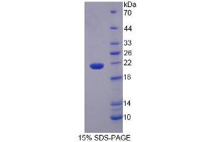 Image no. 1 for Interleukin 1 Family Member 9 (IL1F9) (AA 1-158) protein (His tag) (ABIN6237370)