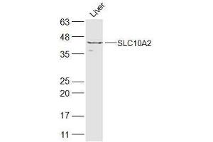 Image no. 1 for anti-Solute Carrier Family 10 (Sodium/bile Acid Cotransporter Family), Member 2 (SLC10A2) (AA 131-230) antibody (ABIN5608770)