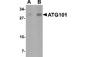 Image no. 2 for anti-Chromosome 12 Open Reading Frame 44 (C12orf44) (Middle Region) antibody (ABIN1030867)