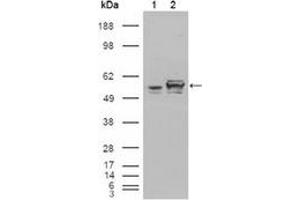 Image no. 1 for anti-Calreticulin (CALR) antibody (ABIN1105643)