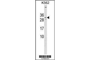 KCNE4 antibody  (Center)