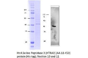 Image no. 2 for HtrA Serine Peptidase 3 (HTRA3) (AA 18-453) protein (His tag) (ABIN3092994)