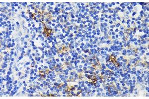 Immunohistochemistry of paraffin-embedded Human tonsil using TREM2 Polyclonal Antibody at dilution of 1:200 (40x lens).