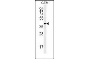Image no. 4 for anti-Osteoglycin (OGN) (AA 253-284), (C-Term) antibody (ABIN953447)