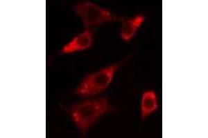 Image no. 1 for anti-Neurotensin Receptor 1 (High Affinity) (NTSR1) (Internal Region) antibody (ABIN6259271)