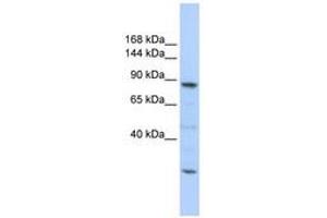 Image no. 1 for anti-CDC5 Cell Division Cycle 5-Like (S. Pombe) (CDC5L) (C-Term) antibody (ABIN6740663)