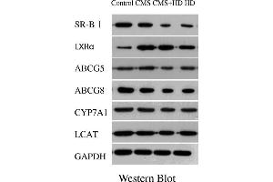 Image no. 3 for anti-ATP-Binding Cassette, Sub-Family G (WHITE), Member 5 (ABCG5) (AA 251-350) antibody (ABIN708371)