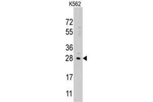 Image no. 1 for anti-Lin-28 Homolog B (LIN28B) (Center) antibody (ABIN357013)